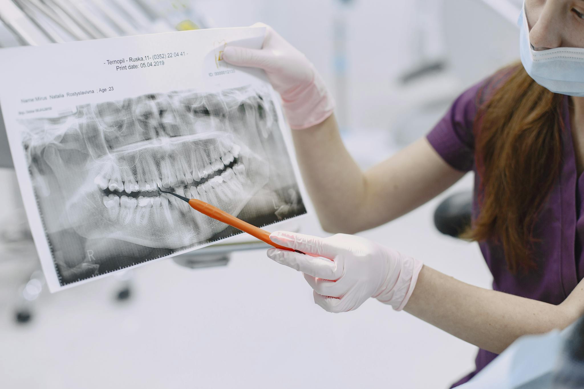 Dentist showing and explaining dental X-ray results to a patient during consultation.