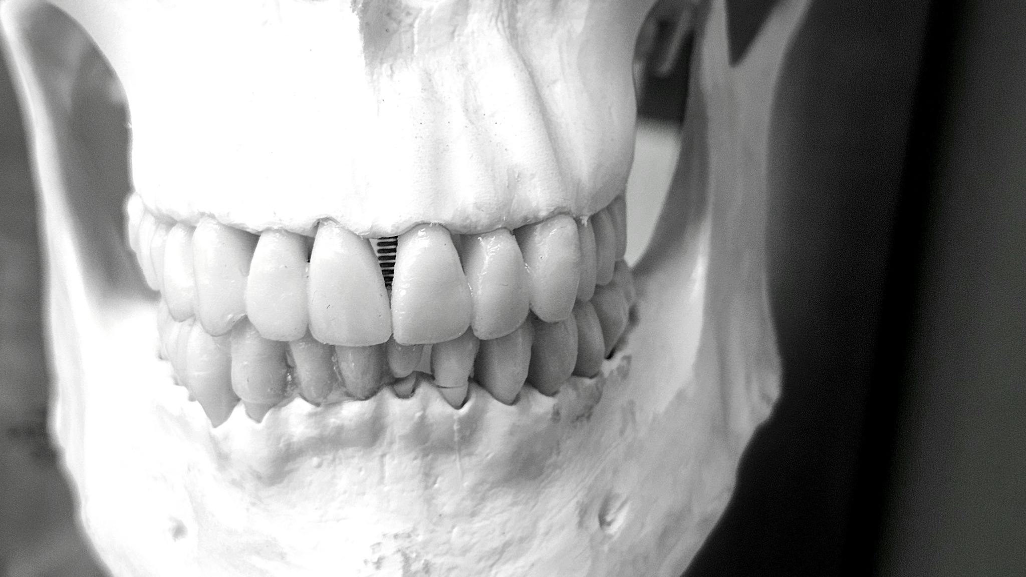 Detailed image of a human skull showcasing dental structure and alignment in a medical context.